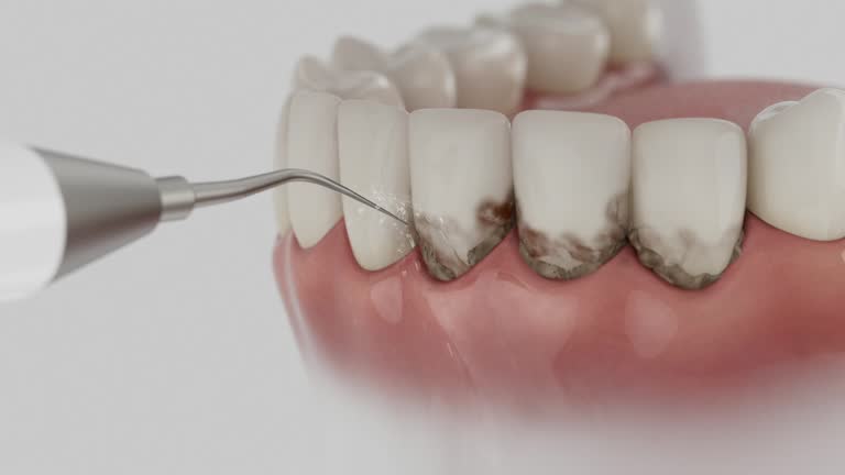 Reliable Tooth Extraction contractor in Iroquois County County, IL by Dentist Open Now